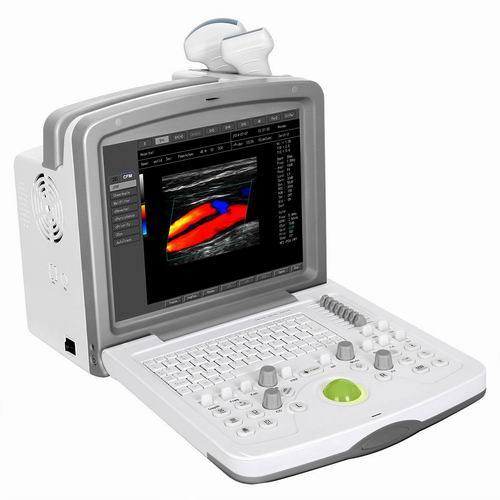 (MS-C5500) Scanner ultrasonique Doppler couleur portable pour système de diagnostic 4D