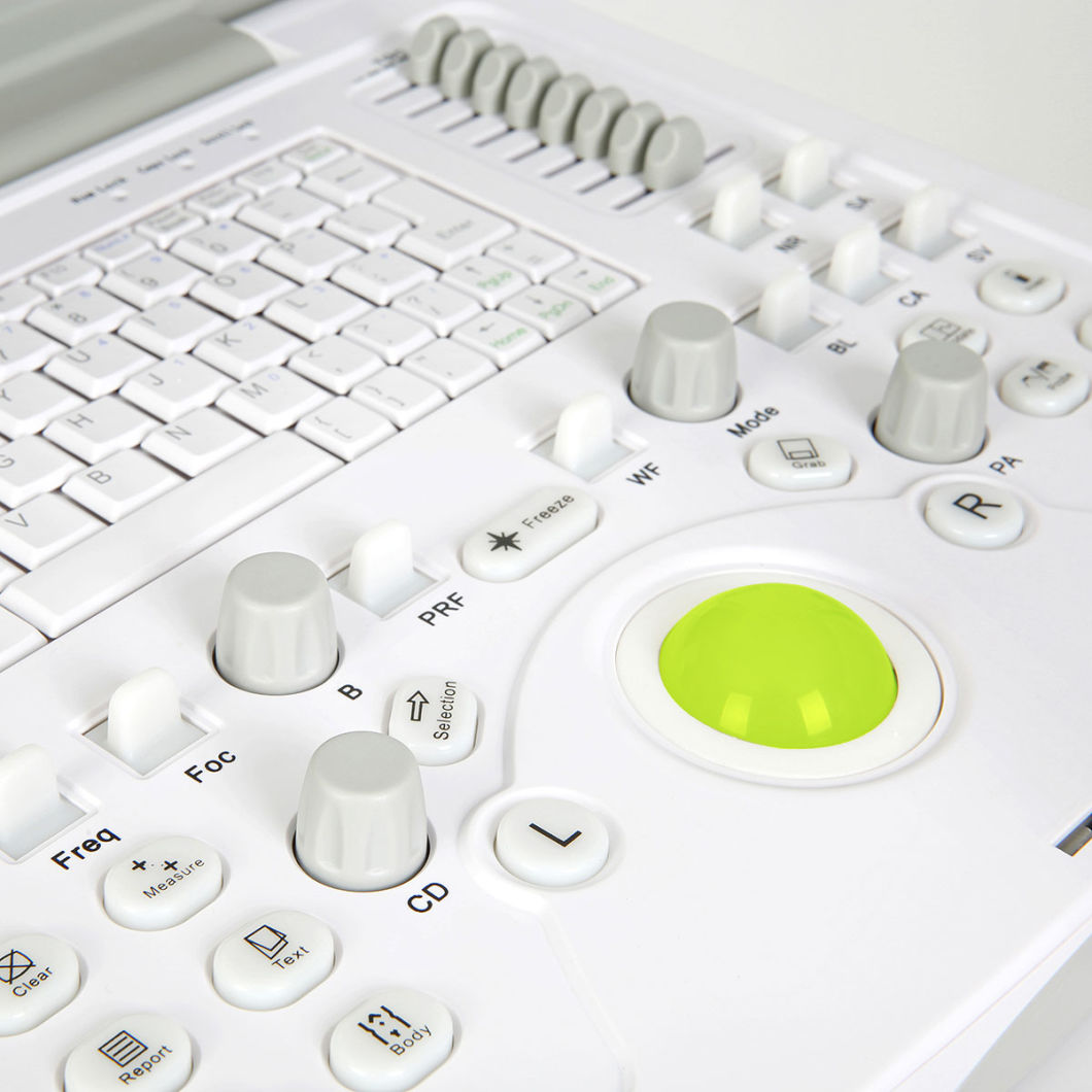 (Ms-C5500) Ordinateur portable entièrement numérique 4D Scanner à ultrasons Doppler couleur numérique