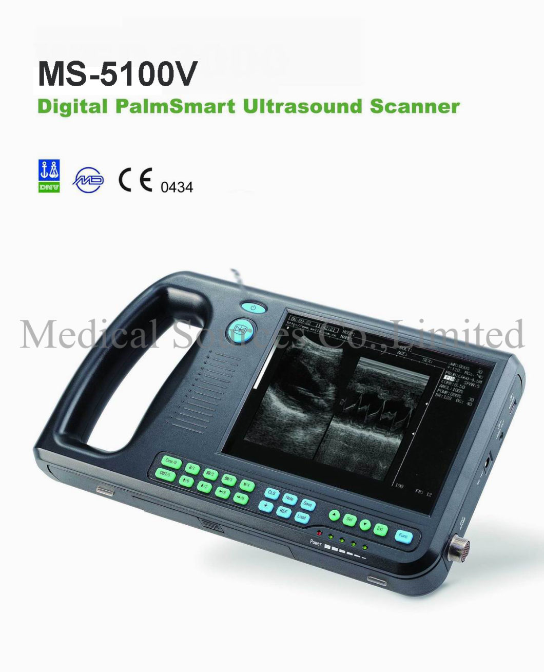 (MS-5100V) Port&aacute;til Digital Palmsmart Veterinary Vet Esc&aacute;ner de ultrasonido port&aacute;til