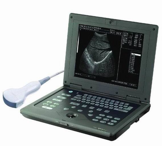 (MS-5000) Laptop Notebook Scanner Unit Digital Portable Ultrasound Scanner