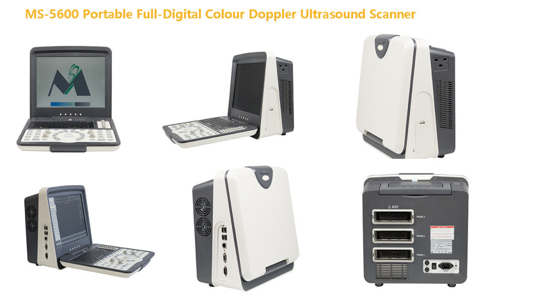 (MS-5600) Portable Full-Digital Colour Doppler Ultrasound Scanner