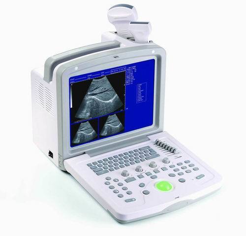(MS-9000AB) Laptop Portable Fully Digital Ultrasound Scanner Black and White Scanner