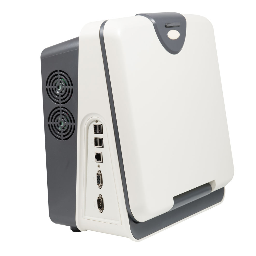 (MS-5600) Portable Full-Digital Colour Doppler Ultrasound Scanner