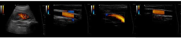 (MS-2000C) Portable Colour Doppler Ultrasound Scan Machine Ultrasound Scanner