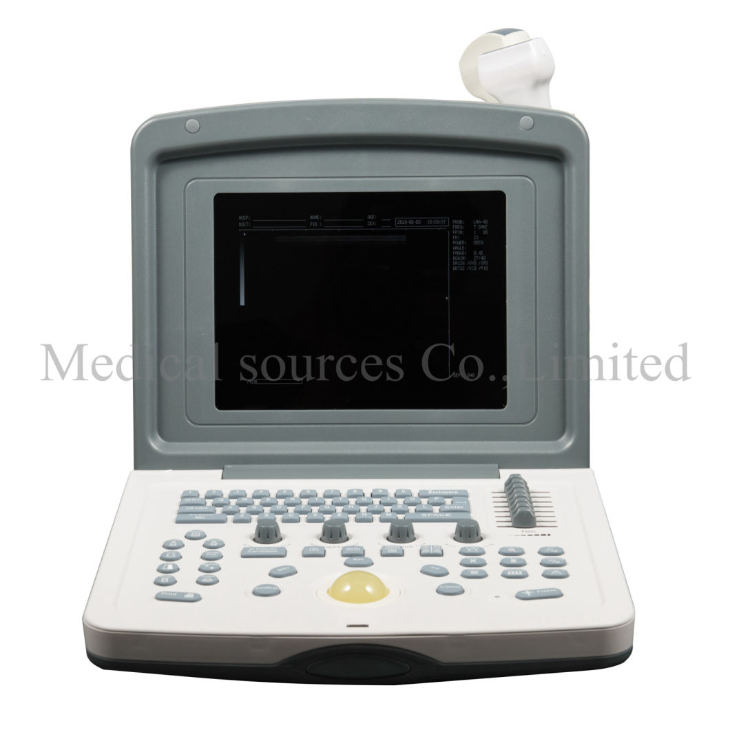 (MS-P800) Best Quality Full Digital Laptop Ultrasound Scanner