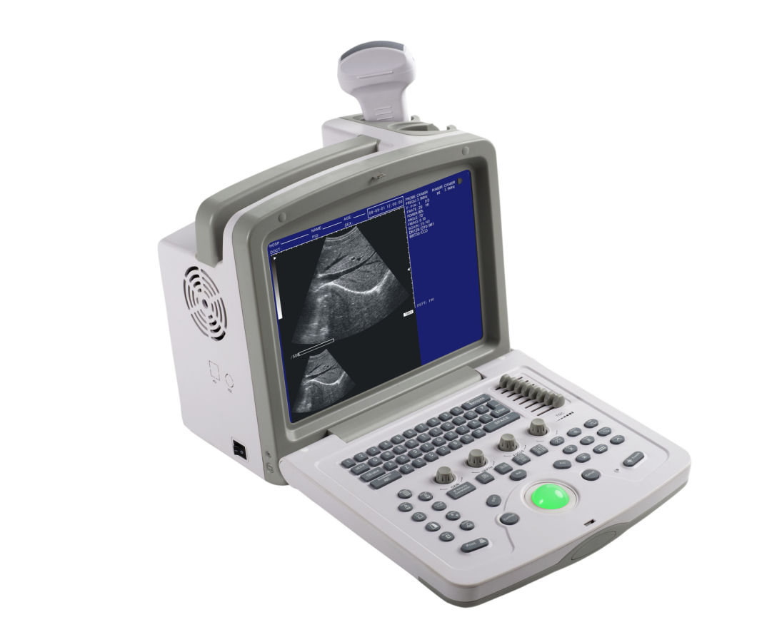 (MS-9000AB) Laptop Portable Fully Digital Ultrasound Scanner Black and White Scanner